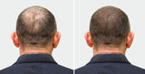 Hair Regrowth Oil & Shampoo